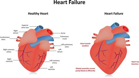 lv hypokinesia|what does severely hypokinetic mean.